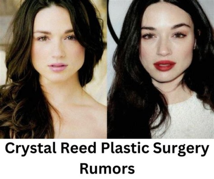 Crystal Reed Plastic Surgery, Real or Rumour |
