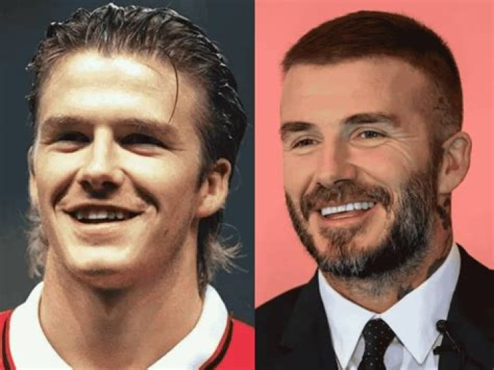 David Beckham's Alleged Plastic Surgery: Uncovering The Truth