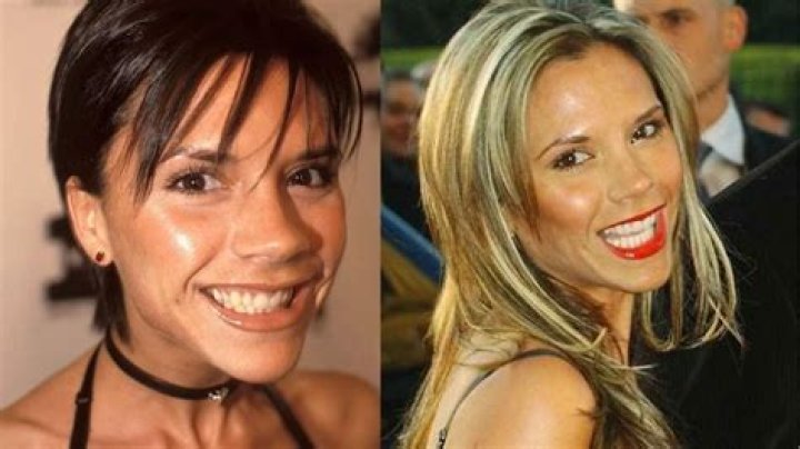 Has Victoria Beckham Done Weight Loss? Before And After Photo |