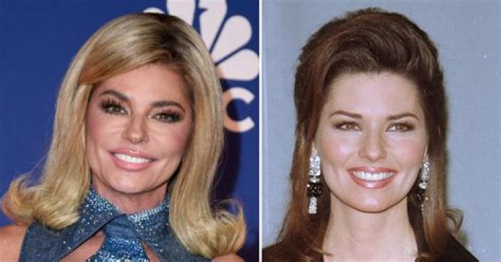 Laura Ingraham: Plastic Surgery Secrets Revealed