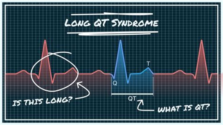 Unveiling The Complexities Of Sarah Katz Long Qt Syndrome