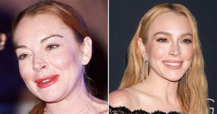 Unveiling The Secrets Of Lindsay Lohan's Nose Job: Discoveries And Insights