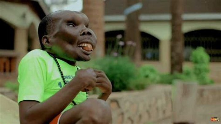 Who is the ugliest man in the world? |